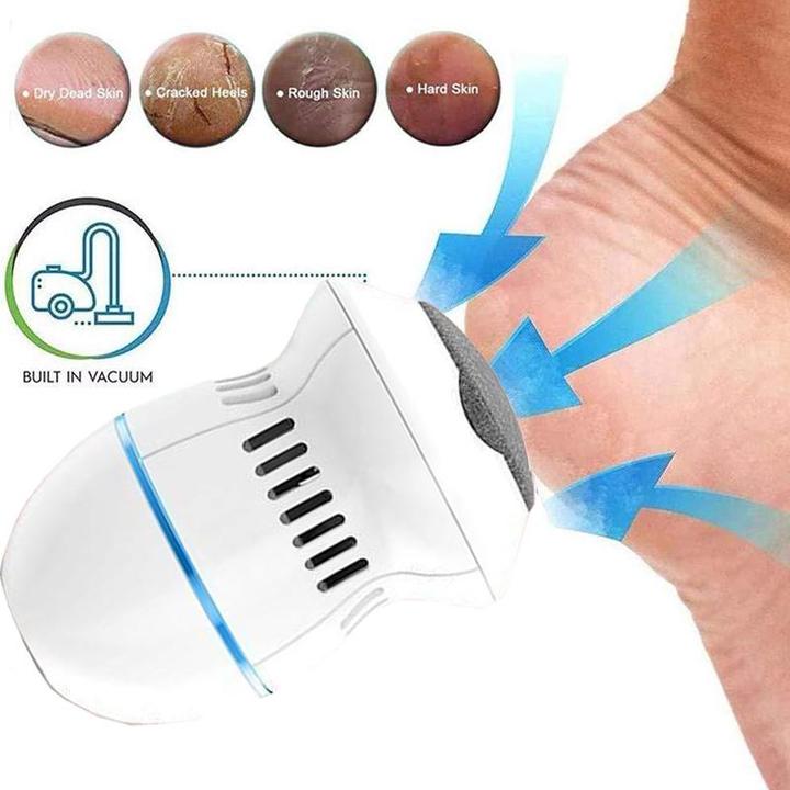 Vacuum Callus Remover And Collector